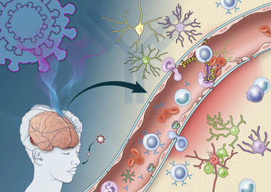 研究揭示新冠引发的免疫反应如何损害大脑