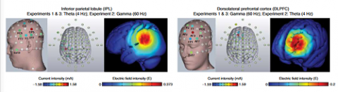 脑电刺激能提高记忆力，效果可维持至少一个月